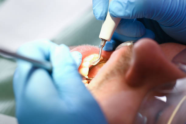 Best Emergency Root Canal Therapy in Frazier Park, CA